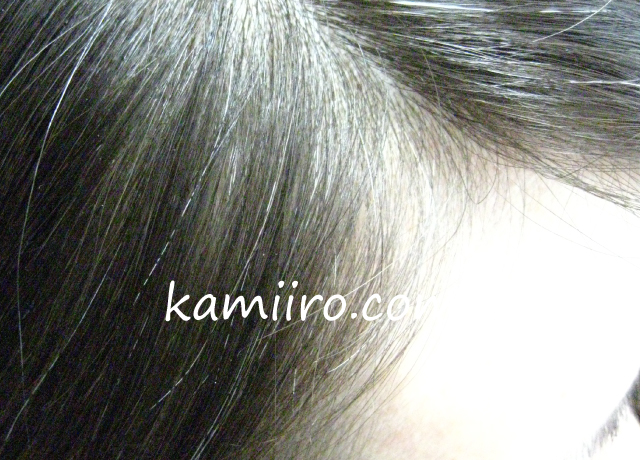 nahokoさんの髪の生え際を撮影した写真